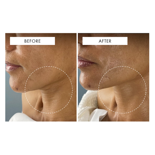 Celestial Black Diamond Cream