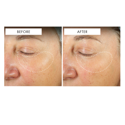 Celestial Black Diamond Eye Cream